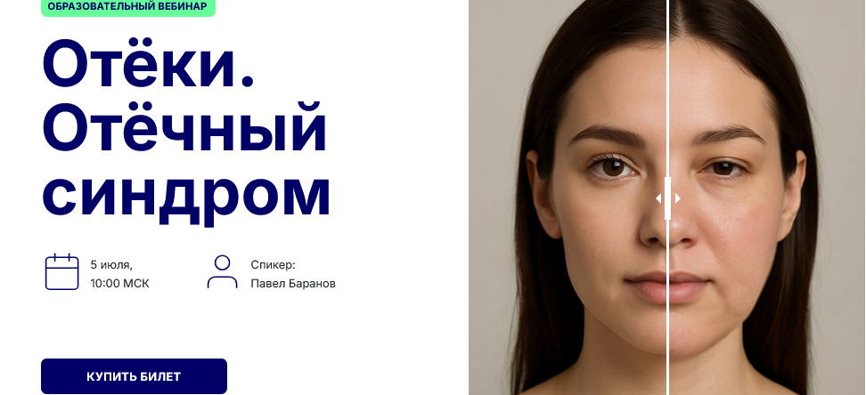 [Павел Баранов] Отёки. Отёчный синдром (2025)_0.png